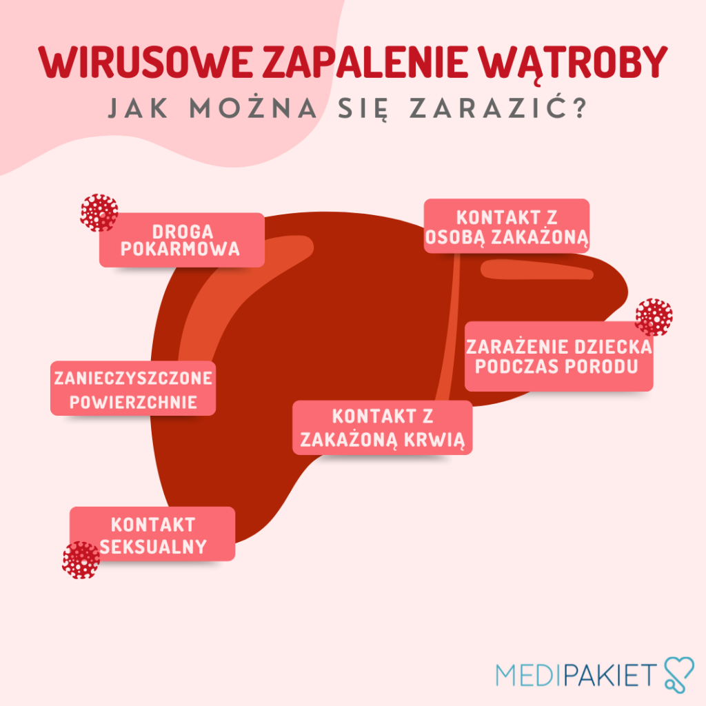 wirusowe zakażenie wątroby